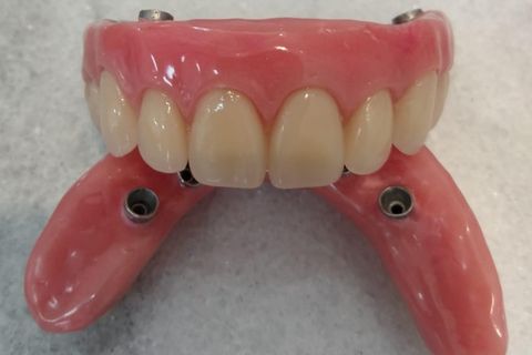 DrLeo-implantes-004 Implantes Dentários em Lavras